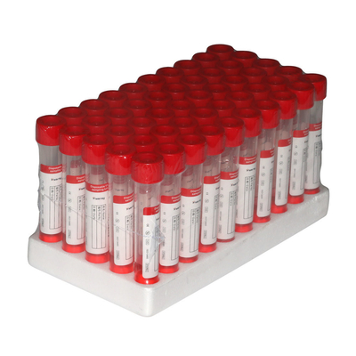 media virali Kit Inactivation Non Inactivation Sampling di trasporto di 2ml VTM