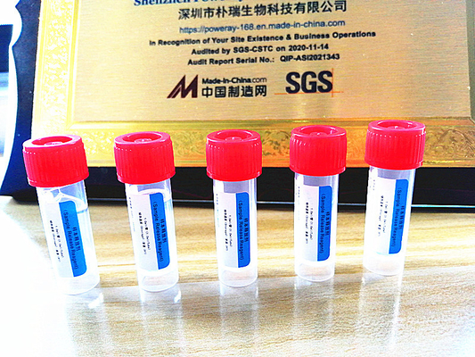 Estrazione domestica del DNA e del RNA del corredo della prova di PCR di approvazione dello SGS per Covid-19
